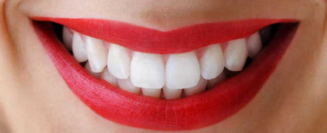 Dentes brancos.